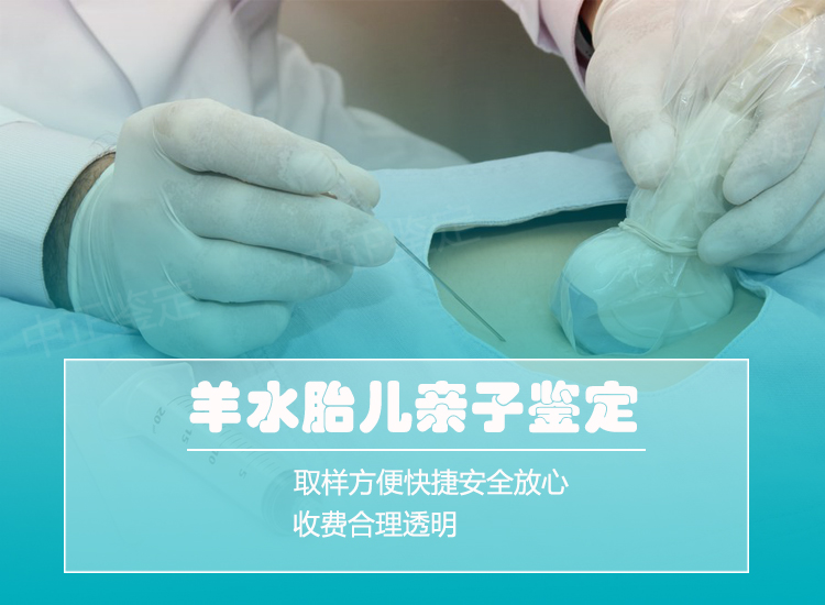慈溪市羊水孕期亲子鉴定